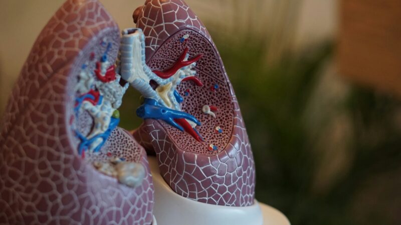 Model lungs