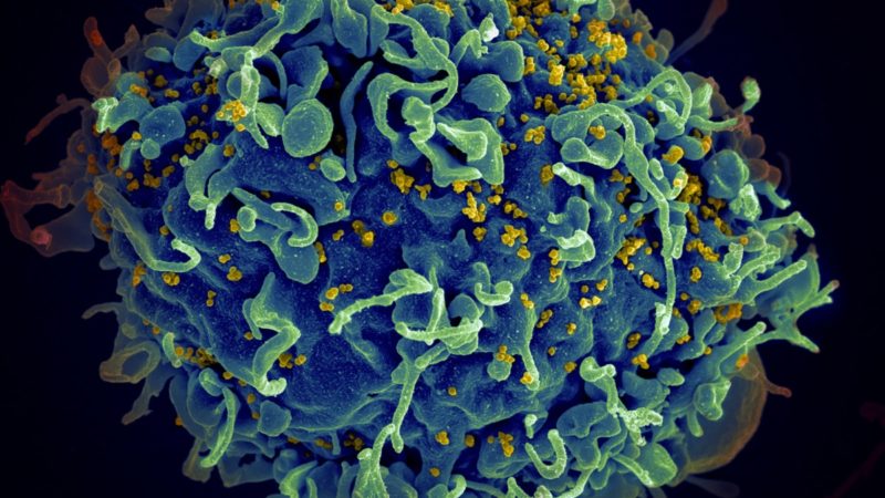 HIV virus up close