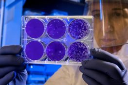 Researcher looking at petri dish